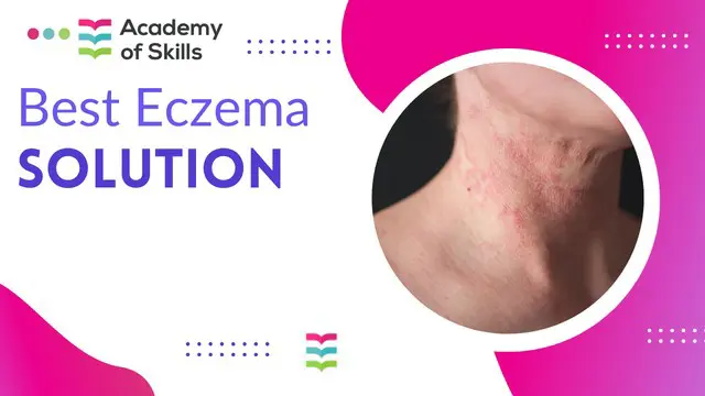 Best Eczema Solution