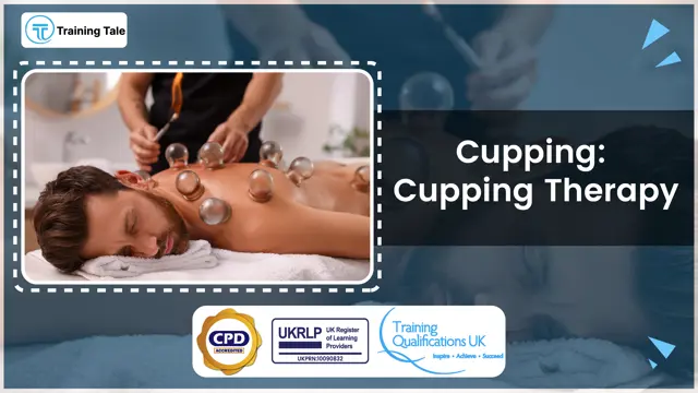 Cupping: Cupping Therapy