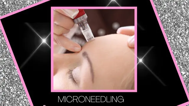 Microneedling Accredited Course
