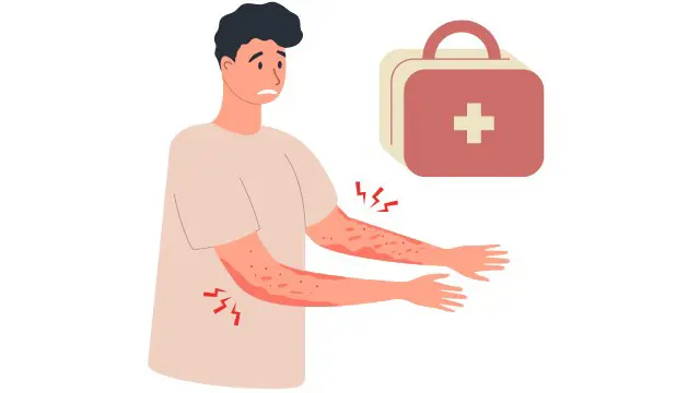 Dermatology & Skincare: Eczema Solution