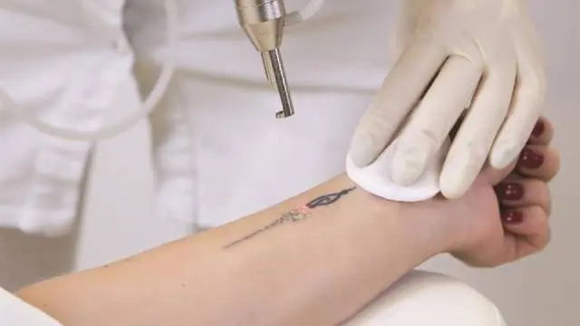Tattoo Infection Control