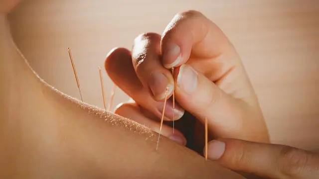 Acupuncture : Understanding Acupuncture