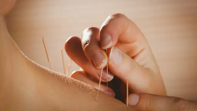 Diploma in Acupuncture