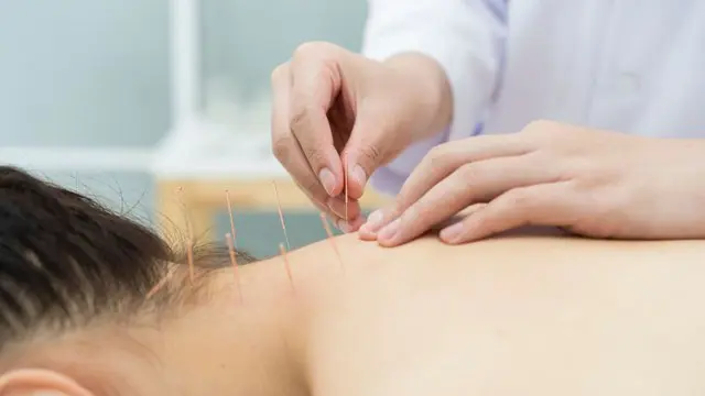 Acupuncture Training