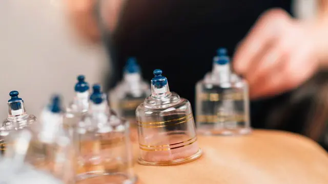 Clinical Cupping Therapy