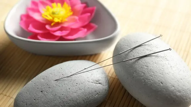 Acupuncture : Reflexology, Aromatherapy & Acupuncture