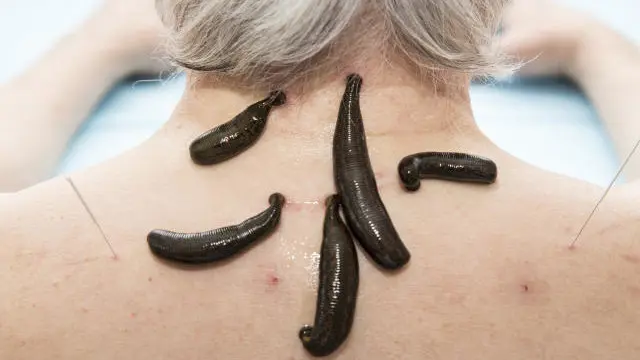 Clinical Leech Therapy Certificate Course