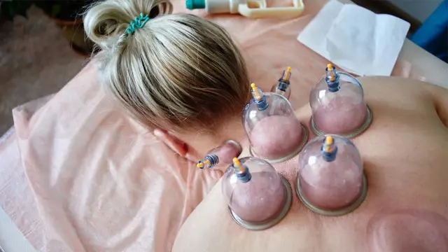 Diploma in Hijama Cupping Therapist Course