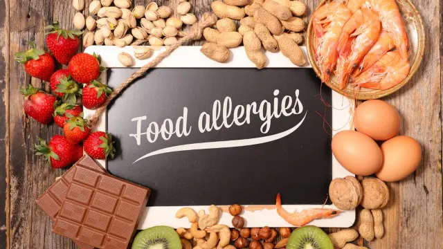 Food Allergies and Special Diets