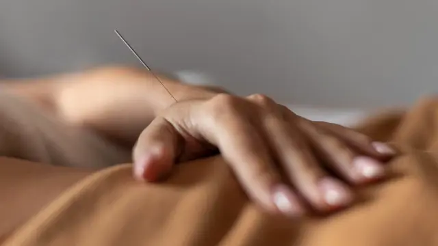 Acupuncture : Acupuncture Training