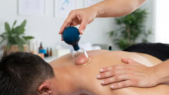 Clinical Cupping Therapy