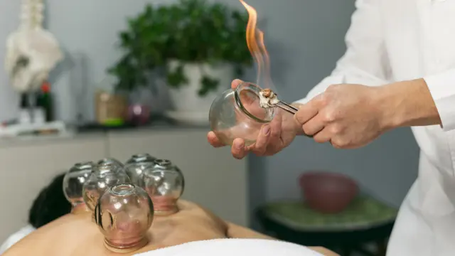 Therapy: Cupping Therapy