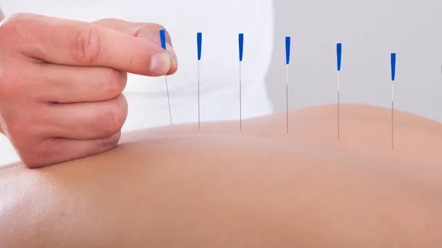 Level 3 Diploma in Acupuncture