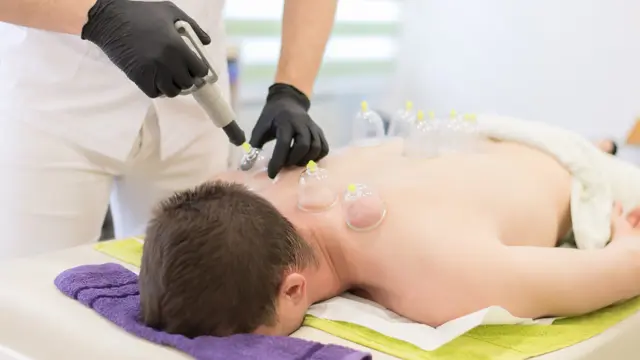 Clinical Cupping Therapy