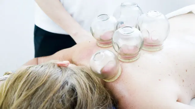 Online Cupping Therapy Diploma