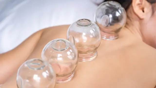 Cupping Therapy : Cupping Therapy Level 3 Diploma