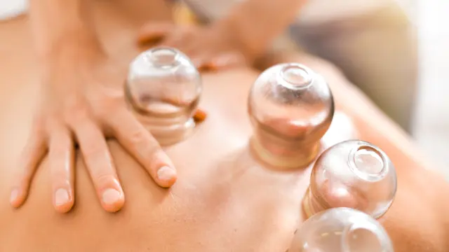 Cupping Therapy : Cupping Therapy Course