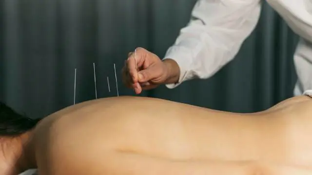 Acupuncture Level 3 Advanced Diploma