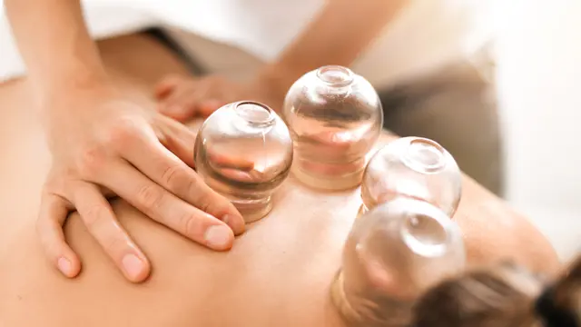 Level 5 Cupping Therapy Training