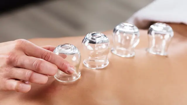 Professional Cupping Therapy