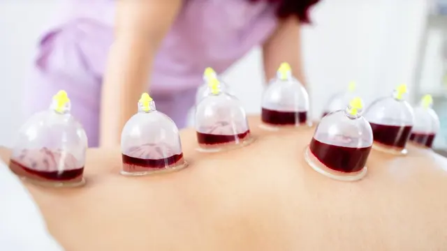 Level 5 Cupping Therapy
