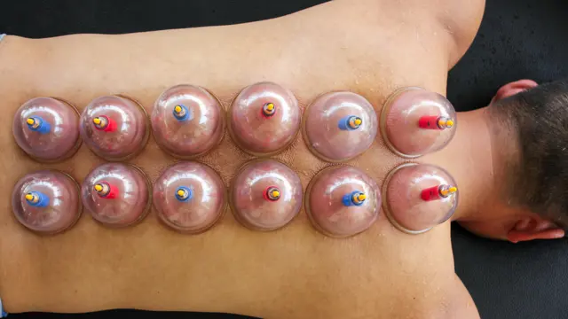 Cupping Therapy & Massage
