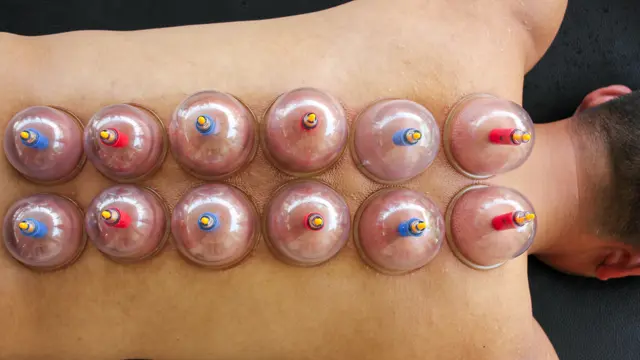 Complete Cupping Course - CPD Certified
