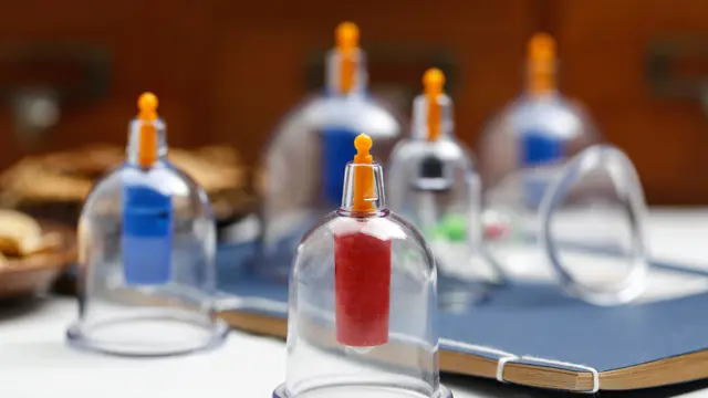 Clinical Cupping : Clinical Cupping Therapy - CPD Certified