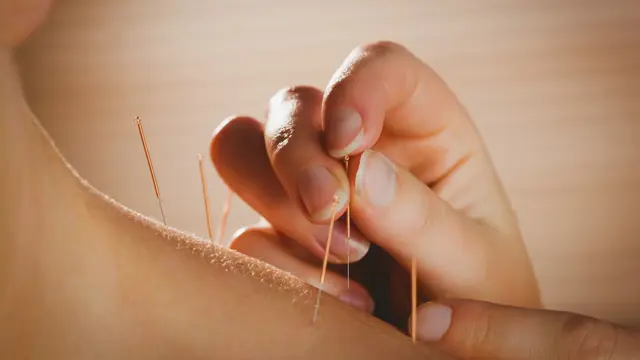 Acupuncture Training - Level 5