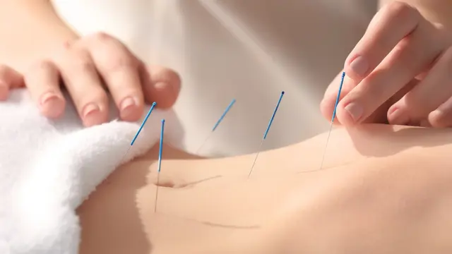 Acupuncture Level 3 Diploma