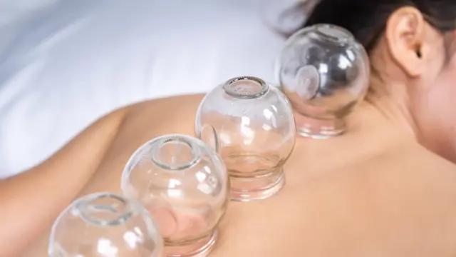 Diploma in Cupping Therapy