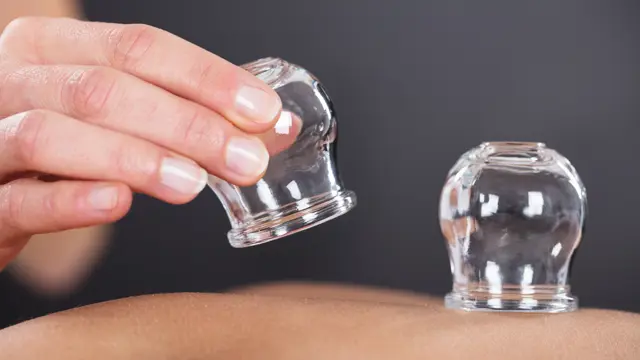 Cupping Therapy - Level 5