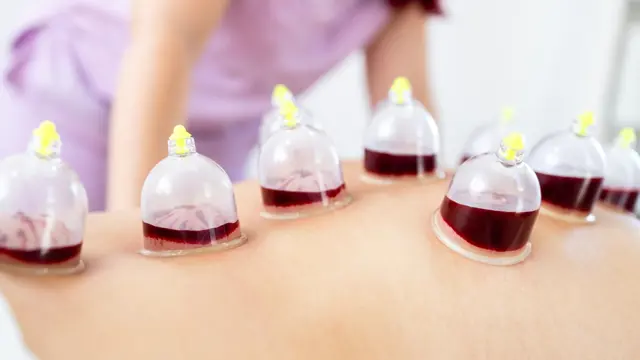 Clinical Cupping Therapy Course