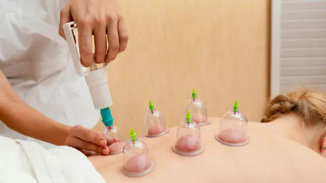 Cupping Therapy Level 3 Advanced Diploma - CPD Accredited