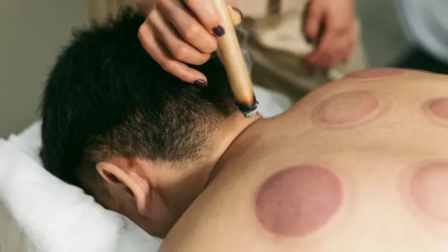 Cupping Massage Mastery