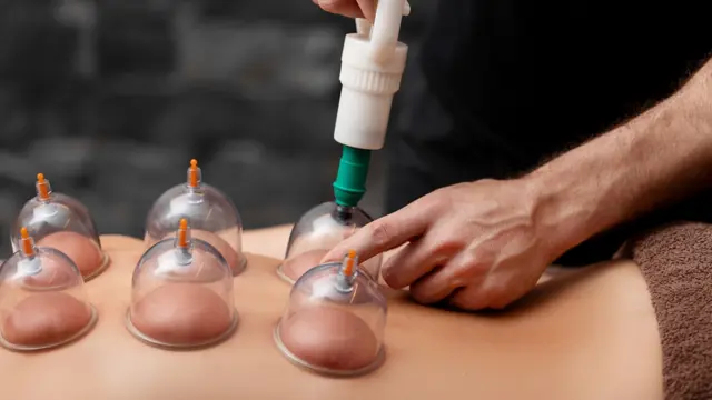 Cupping Therapy - Level 3 Advanced Diploma