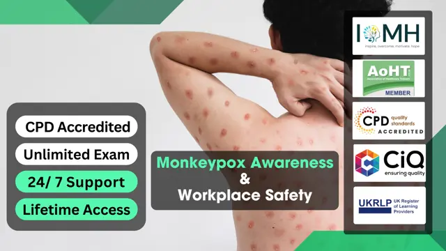 Monkeypox Awareness and Workplace Safety