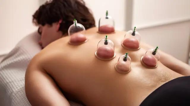 Level 2 Cupping Therapy